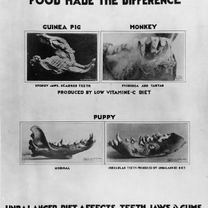 Food made the difference. Unbalanced diet affects teeth, jaws and gums