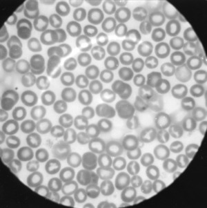 Red blood cells under a microscope