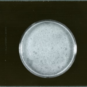 Plaques on three petri dishes: Cultures numbered 32, 35, 31